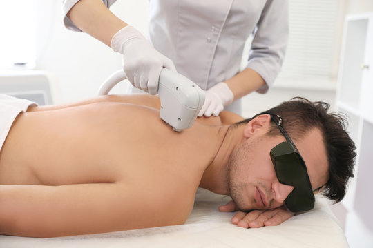 Laser hair removal