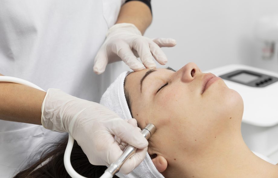 microneedling Toronto